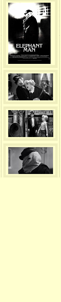 The Elephant Man Recensione